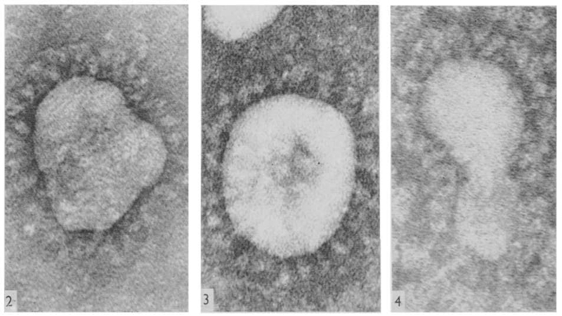 Coronavirus - prime immagini catturate al microscopio da June Hart
